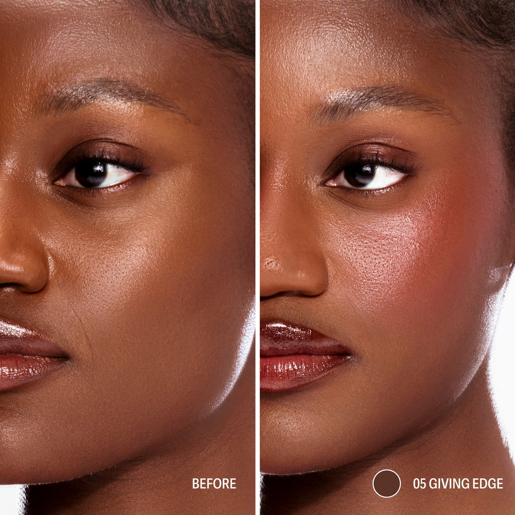Contour STAY-N®